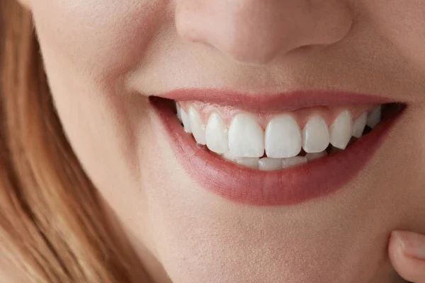 Dientes en un día Ikigai